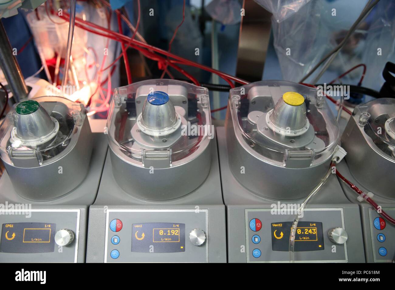 Cardiac surgery hi-res stock photography and images - Alamy