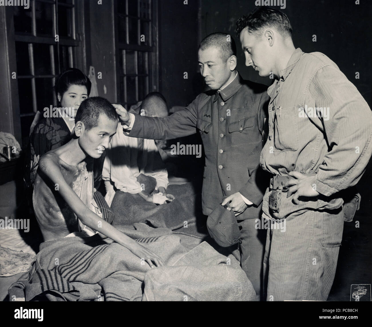 Flash burns patient hires stock photography and images Alamy