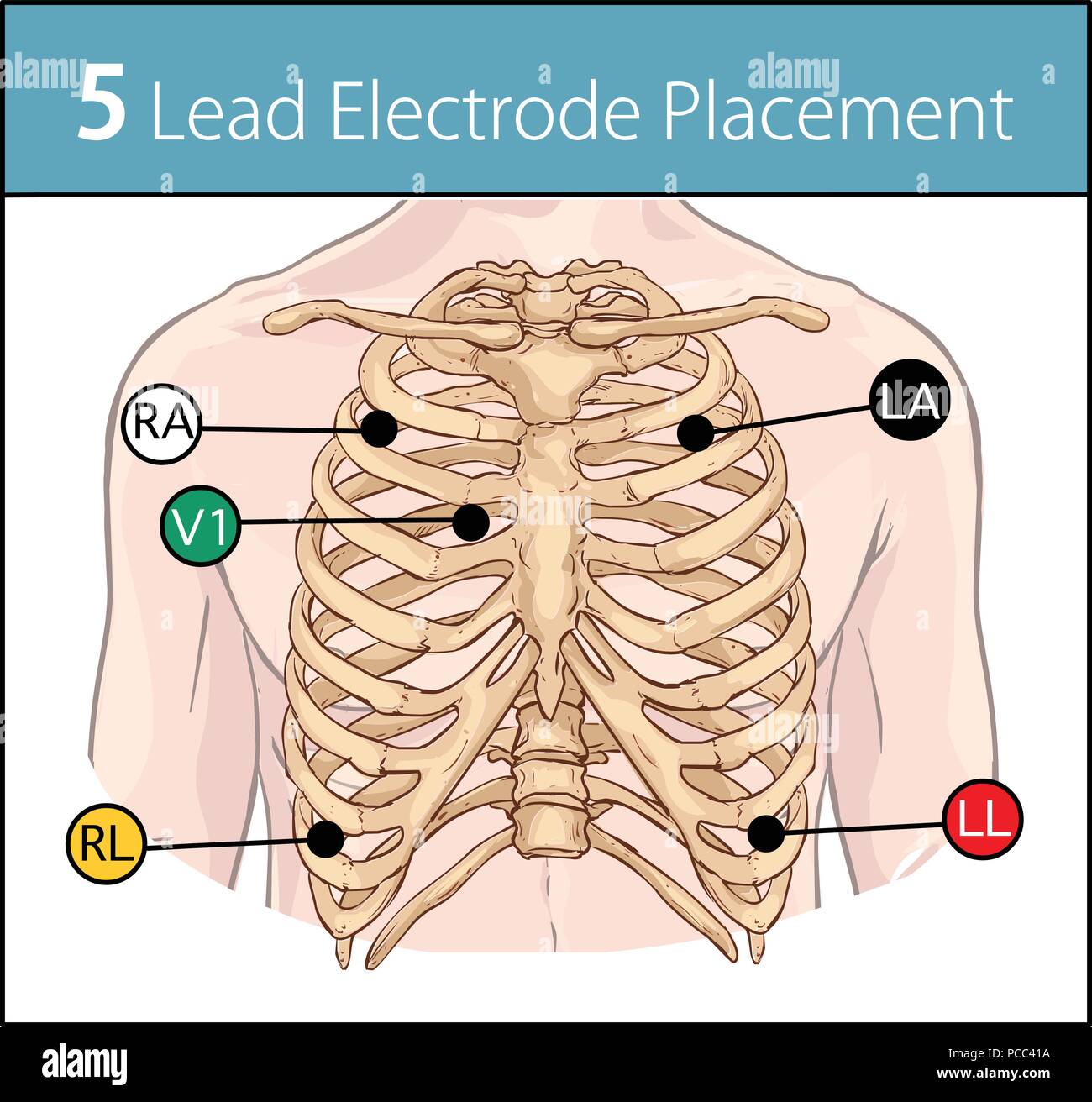 Vector illustration of a 5 lead electrode placement Stock Vector Image