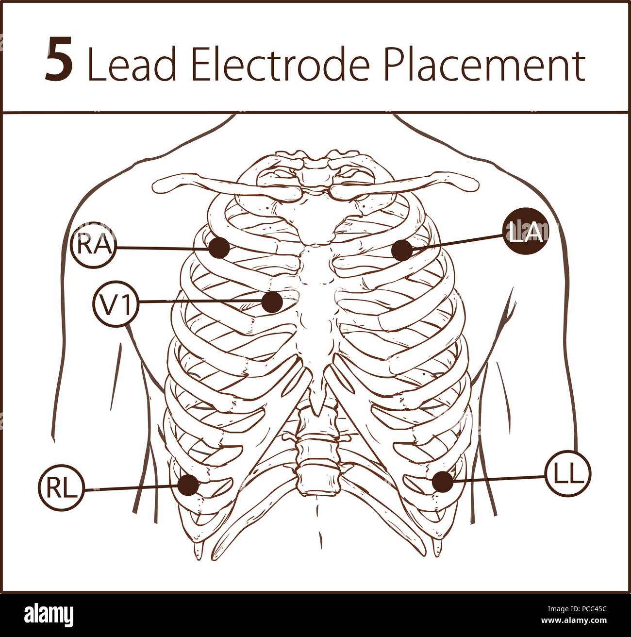 Electrode Placement