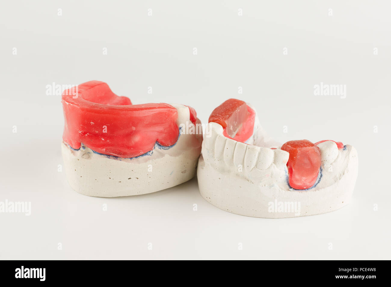wax rollers on the tooth model for determining jaw closure Stock Photo