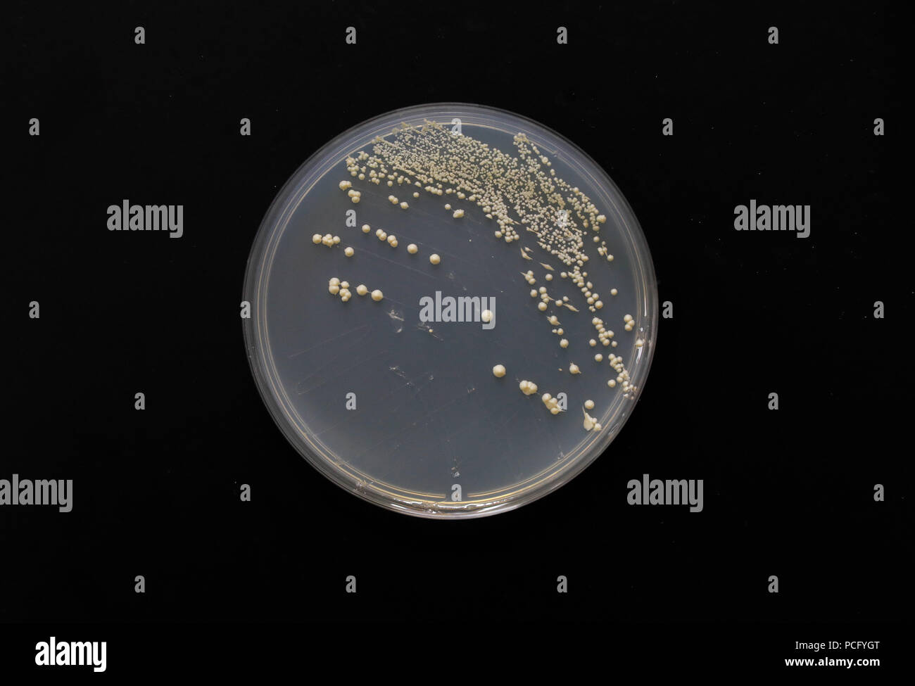 (180802) -- SHANGHAI, Aug. 2, 2018 (Xinhua) -- Photo taken on July 31, 2018 shows single chromosome yeast strain at the Center for Excellence in Molecular Plant Sciences, Shanghai Institute of Plant Physiology and Ecology, of Chinese Academy of Sciences in Shanghai, east China. Brewer's yeast, one-third of whose genome is said to share ancestry with a human's, has 16 chromosomes. However, Chinese scientists have managed to fit nearly all its genetic material into just one chromosome while not affecting the majority of its functions, according to a paper released Thursday on Nature's website. Q Stock Photo