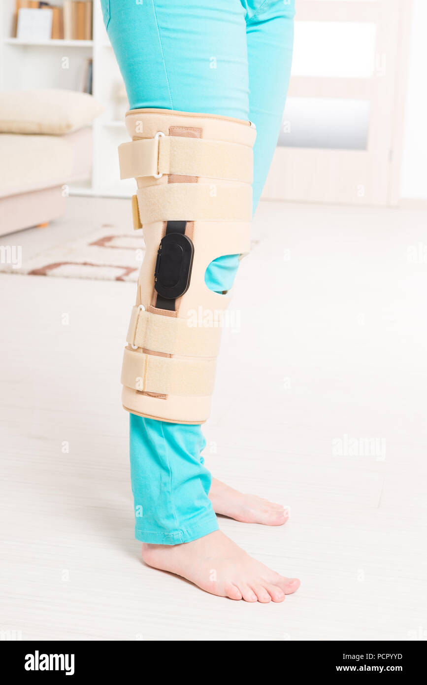 Woman's leg in knee cages for stabilization and support Stock Photo Alamy