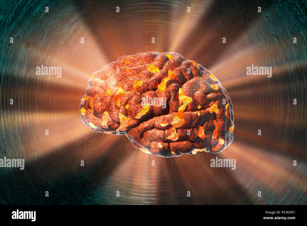 Exploding brain. Conceptual computer illustration of a human brain exploding. This image could represent mental stress or complex thought processes leading to brain overload. Stock Photo