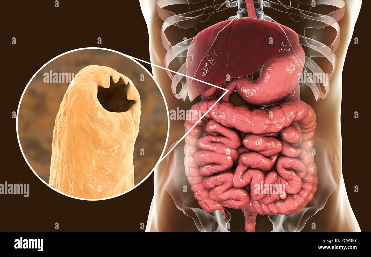feline hookworms in humans pictures feline hookworms in humans pictures