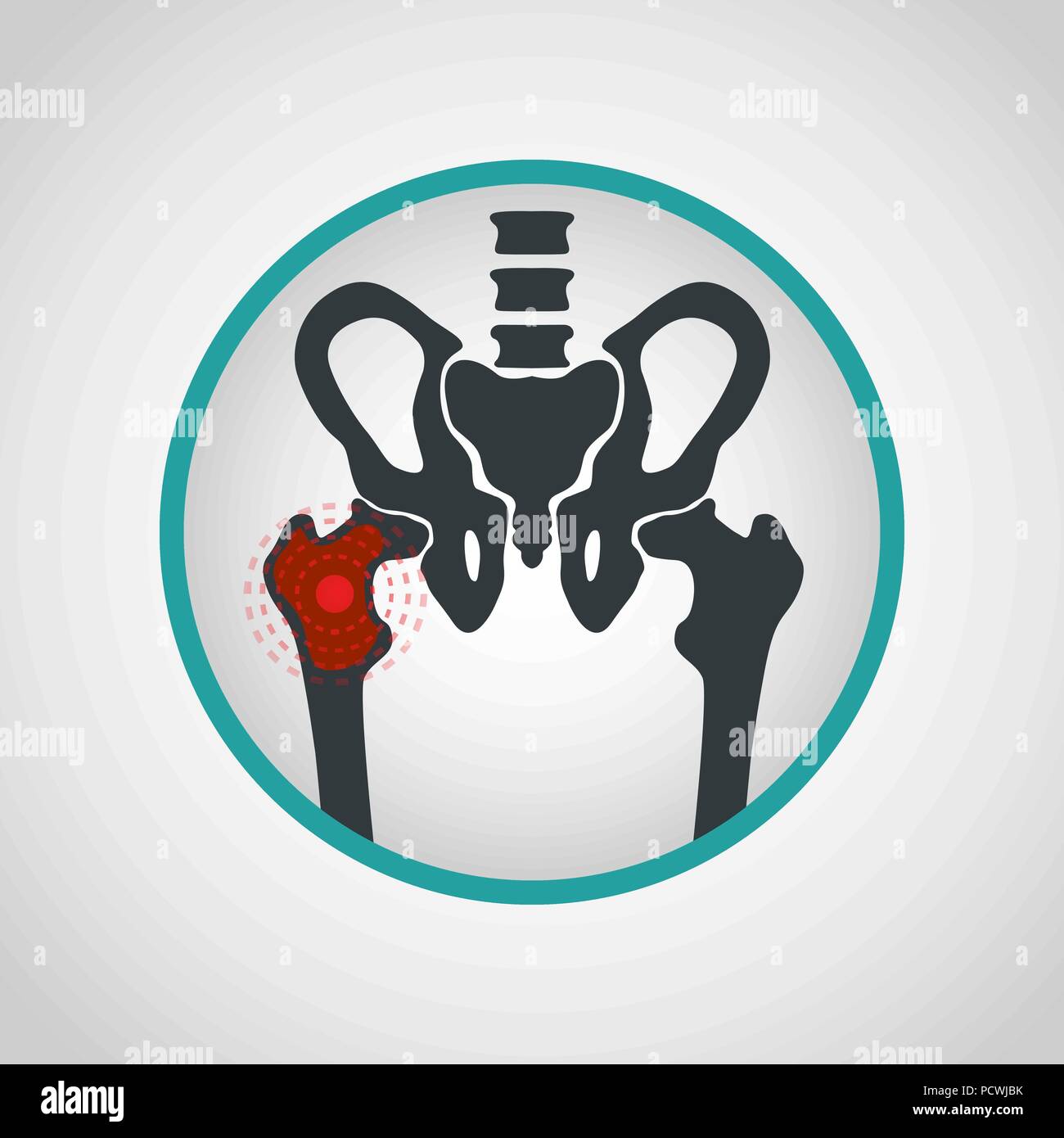 Bone cancer logo vector icon design illustration Stock Vector
