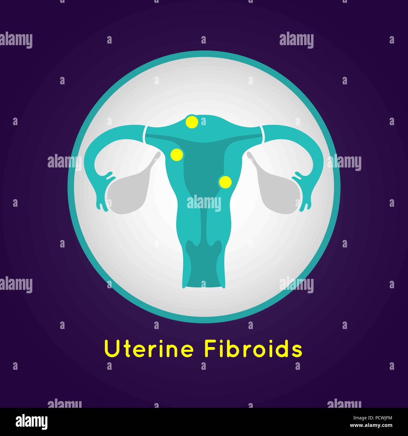 Uterine Fibroids logo vector icon design illustration Stock Vector