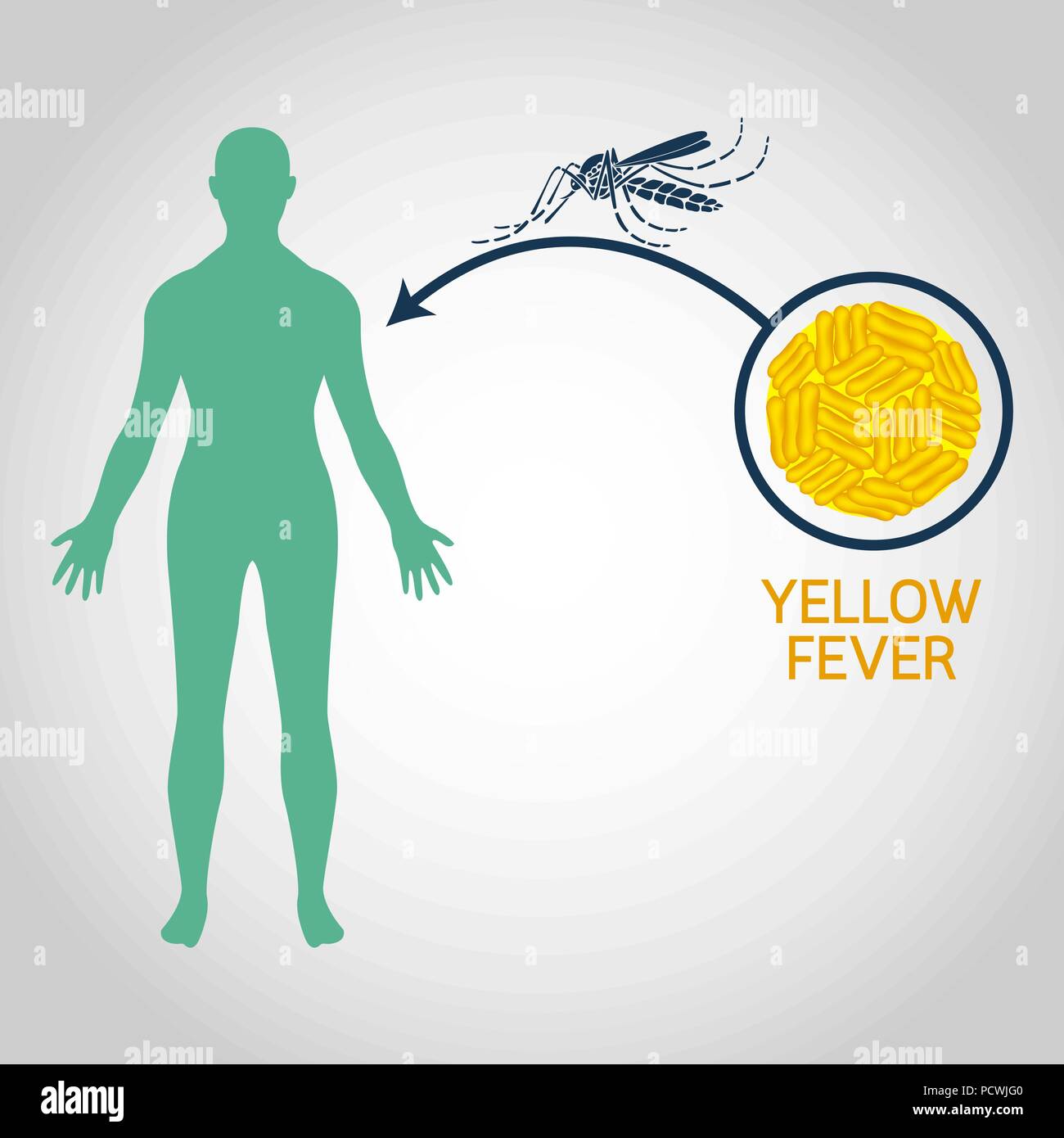 Yellow fever hi-res stock photography and images - Alamy