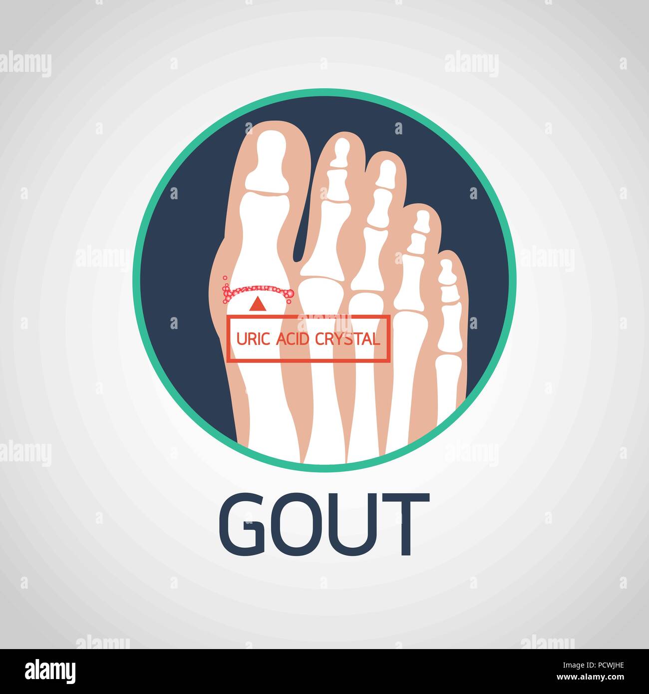 Gout vector logo icon illustration Stock Vector