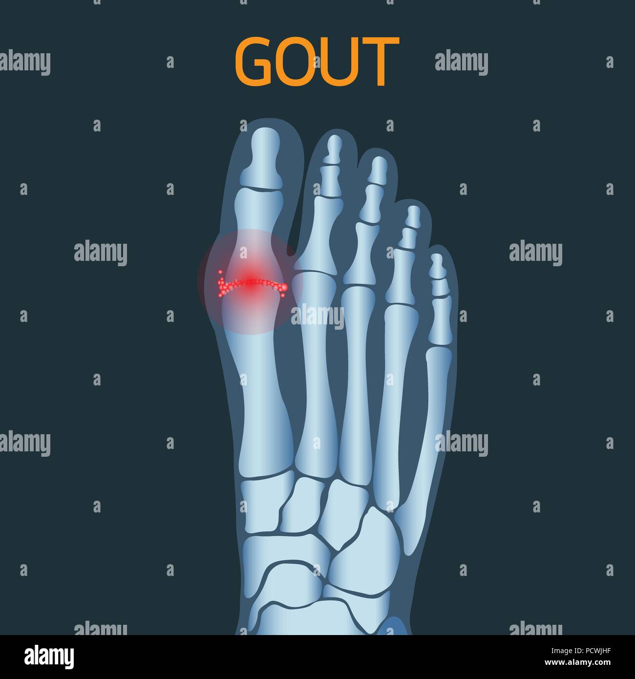 Gout vector logo icon illustration Stock Vector