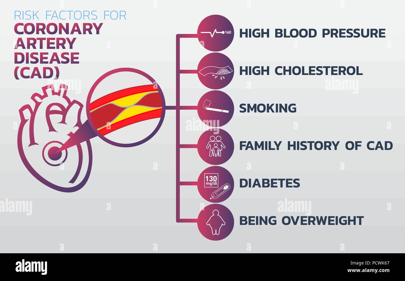 Ischemic heart disease, Ischemic Cardiomyopathy, coronary artery disease (CAD) icon design, infographic health, medical infographic. Vector illustrati Stock Vector