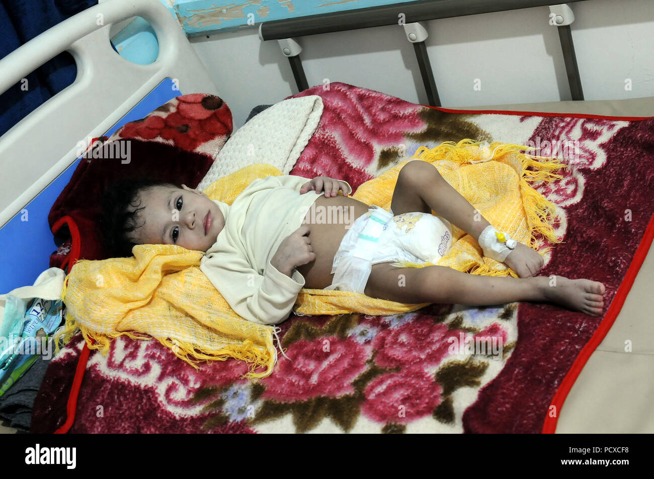 Sanaa, Yemen. 4th Aug, 2018. A child infected by cholera epidemic is treated at a hospital in Sanaa, Yemen, on Aug. 4, 2018. An increasing number of cholera-effected cases in several heavily populated areas over the past few weeks indicates that Yemen may be on the brink of a new cholera epidemic, with a heightened death rate due to widespread malnutrition, and the United Nations is hoping for a ceasefire in the north to allow for vaccinations, the World Health Organization said on Friday. Credit: Mohammed Mohammed/Xinhua/Alamy Live News Stock Photo