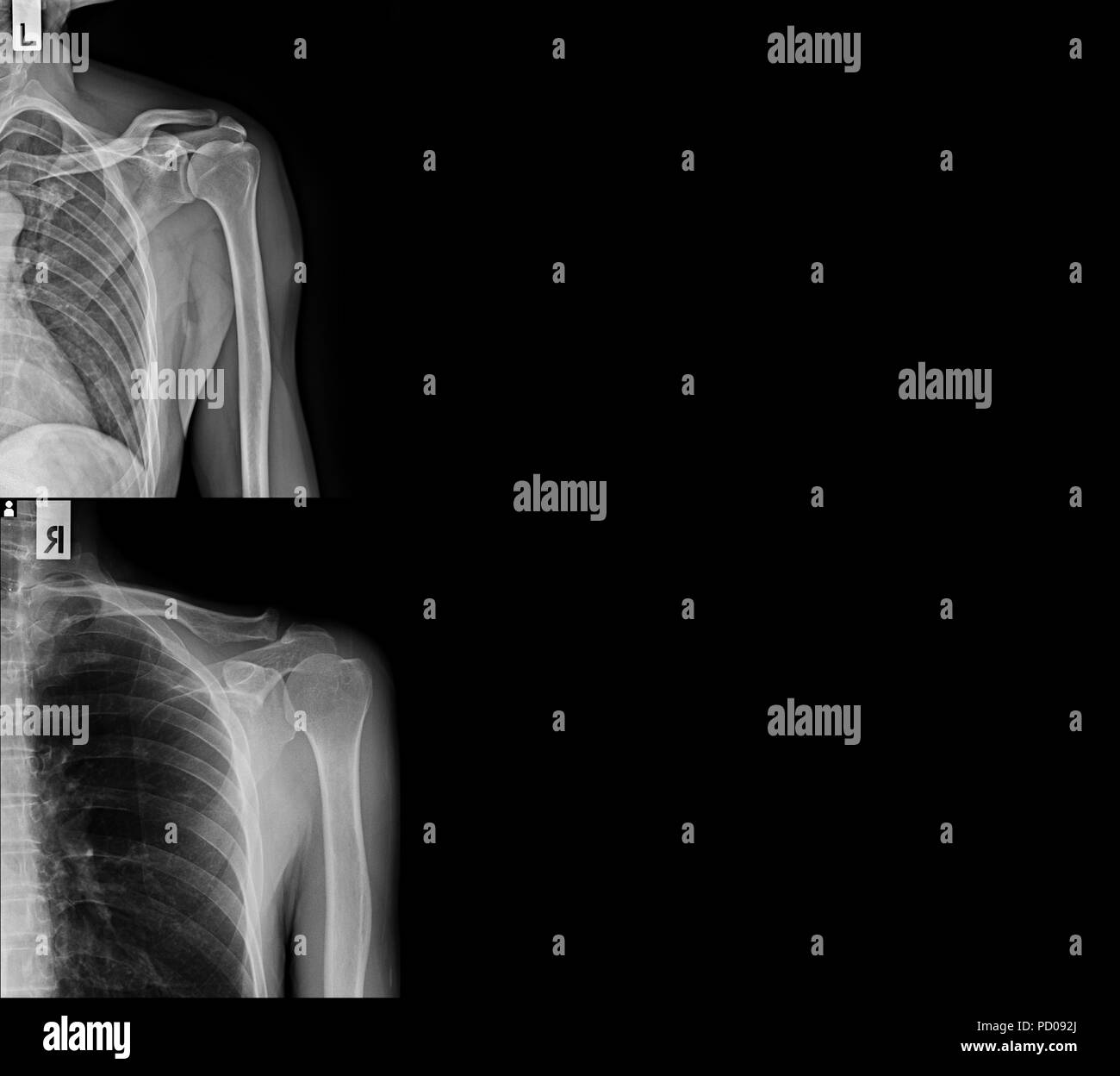 X Ray Banner In Grey Tone Stock Photo 214522074 Alamy