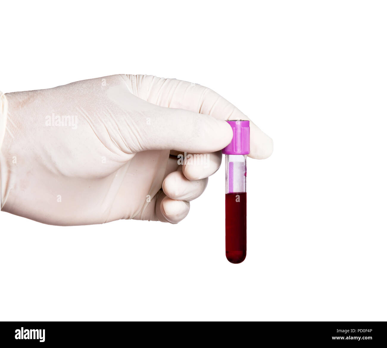 hand holding collection blood specimen isolated on white background