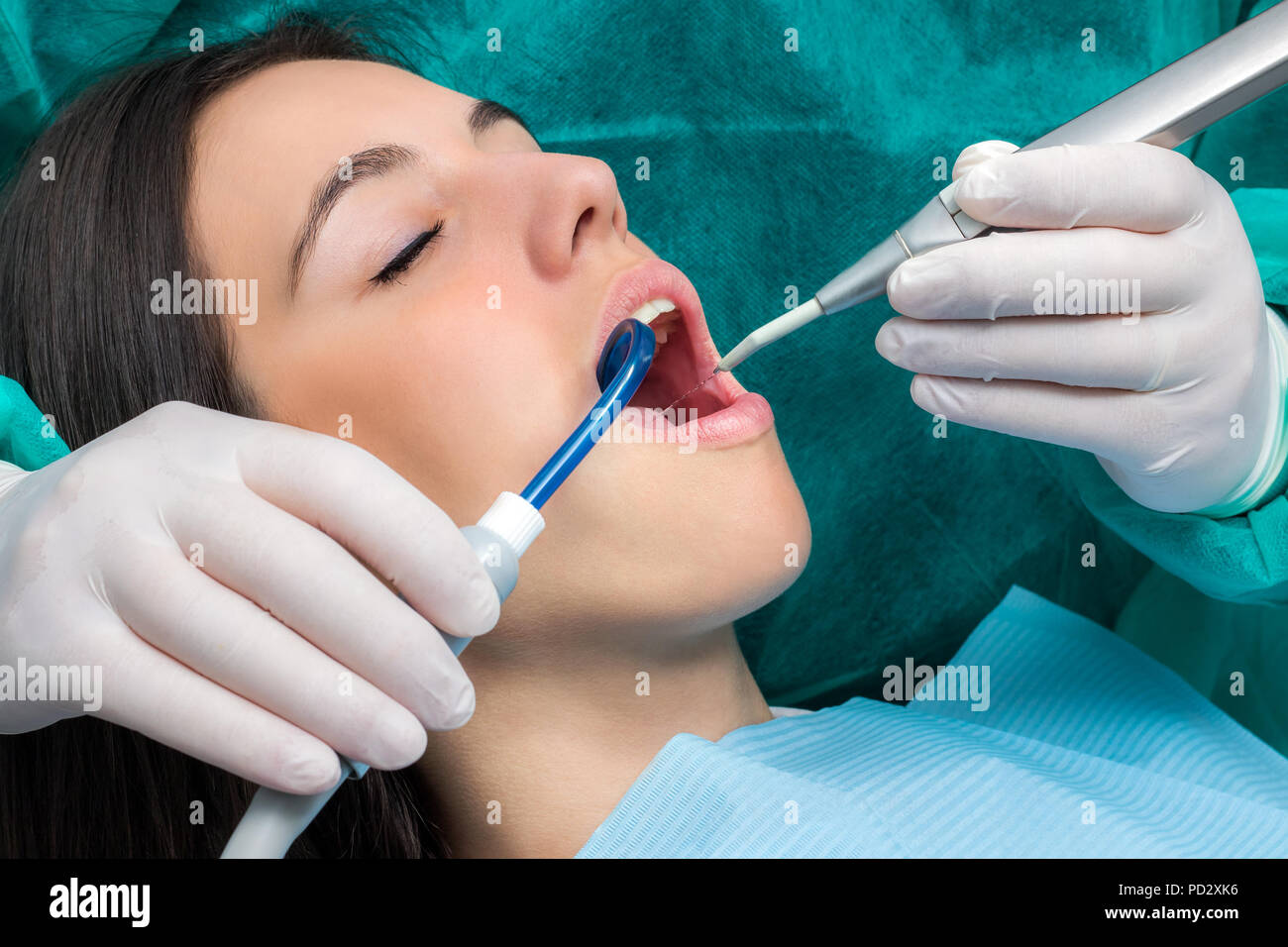 Close up macro face shot of young woman having dental cleaning.Hands wearing gloves working on teeth with saliva ejector and water cleaning unit. Stock Photo