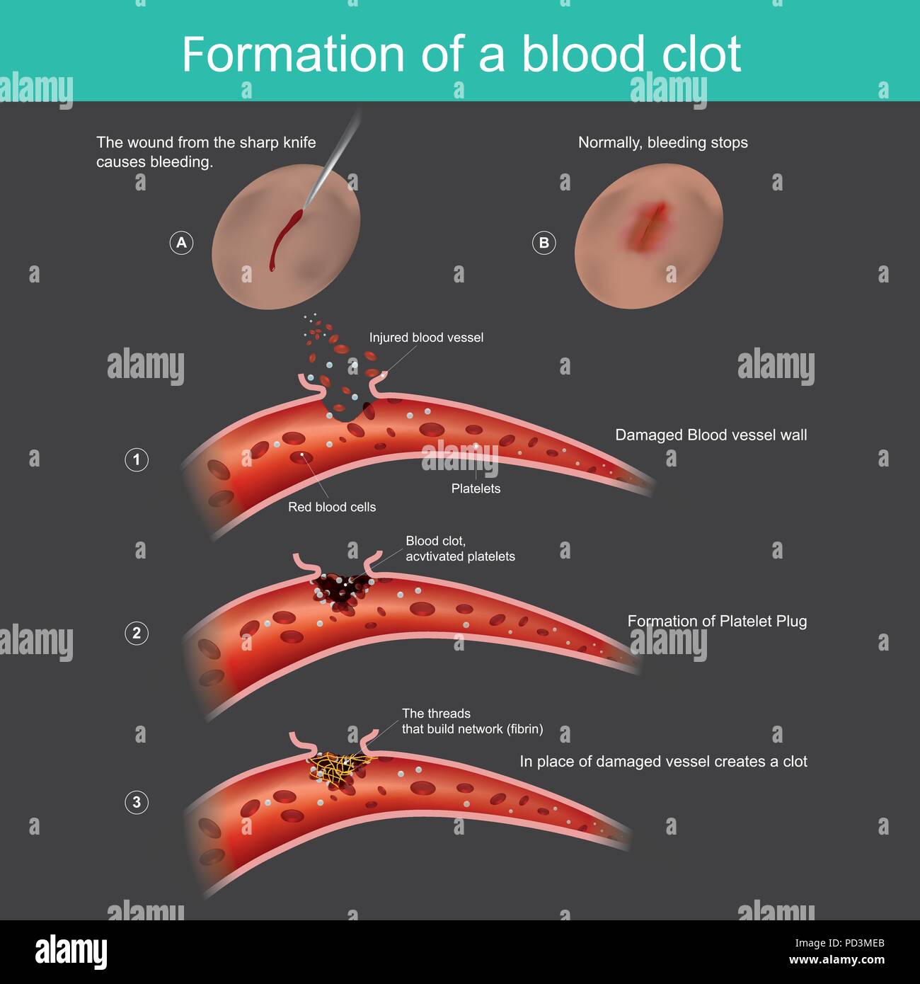 A Big Image Of An Old Dried Red Blood Clot Stock Photo, Picture and Royalty  Free Image. Image 1288955.