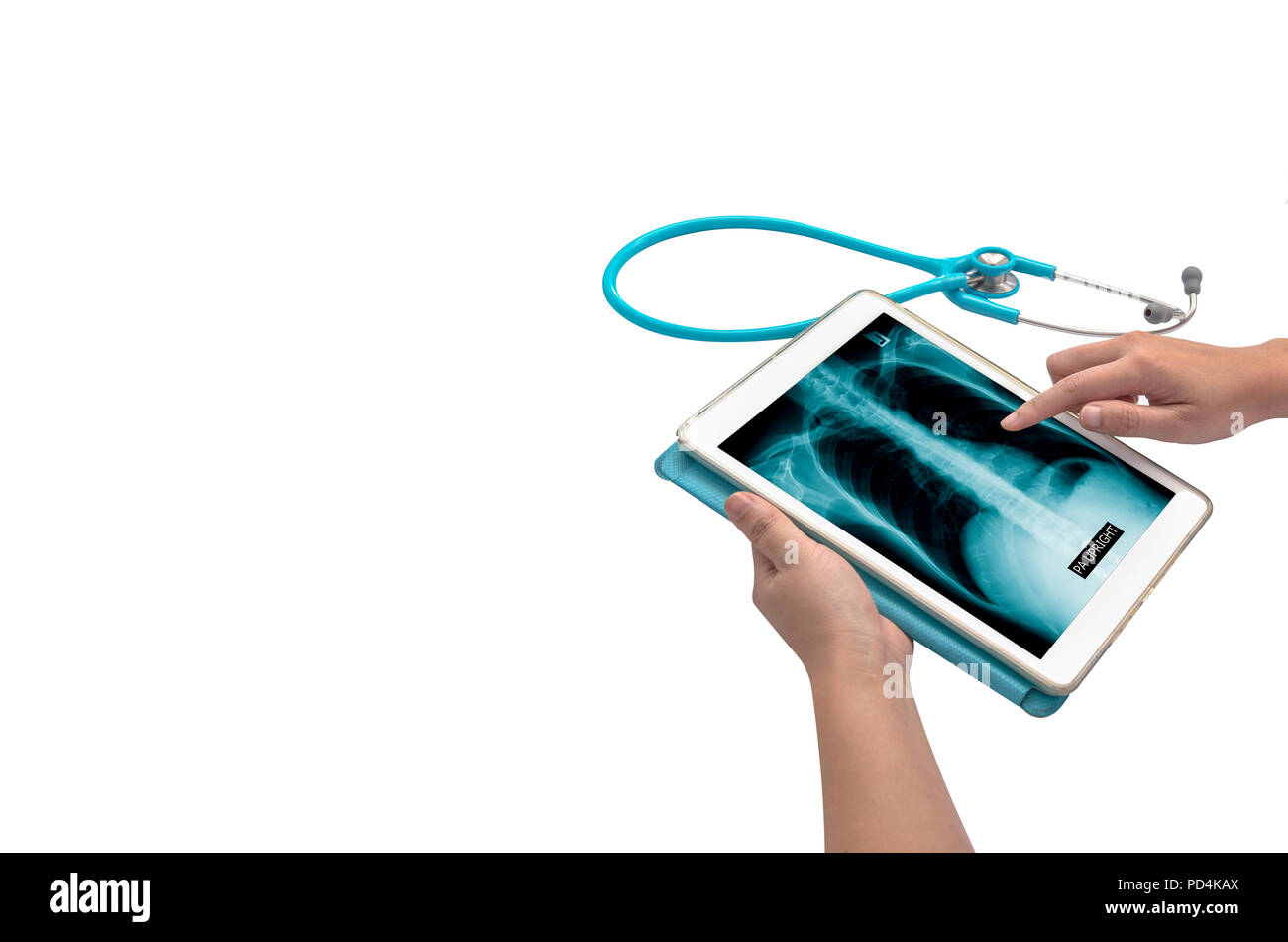 hand touching tablet with x-ray image Stock Photo