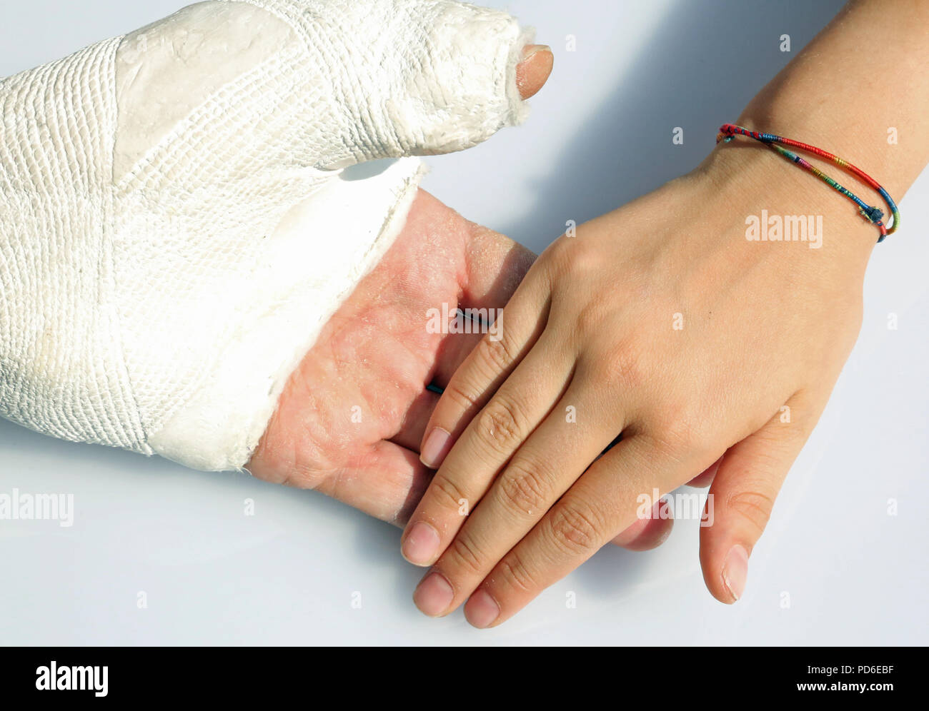 hand of the little girl who gently holds that of her dad after the serious accident and the cast of the fractured hand Stock Photo