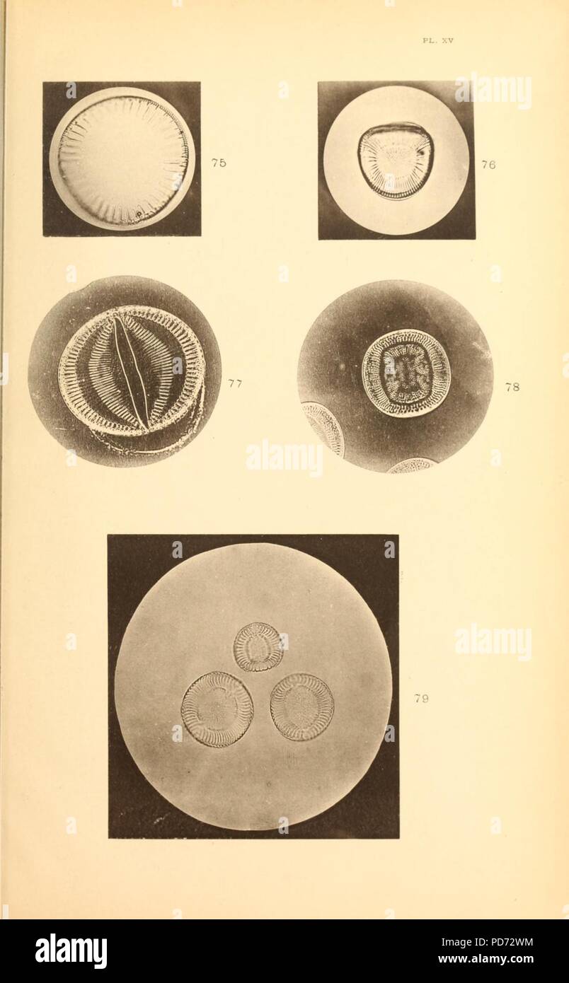 Analysis of the diatomaceous genus Campylodiscus Stock Photo