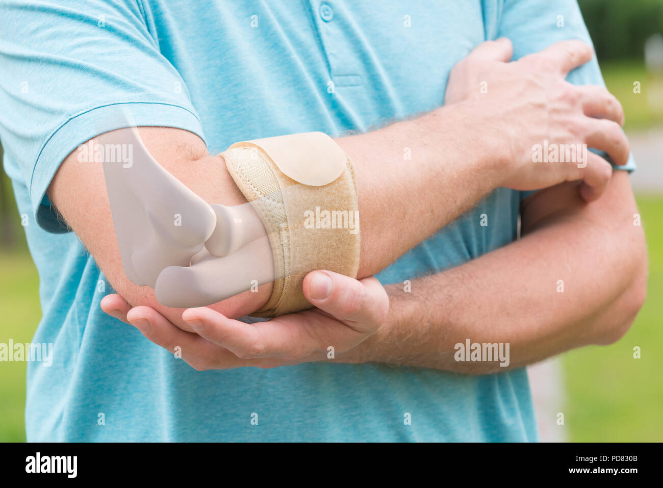 Man wearing elbow brace to reduce pain Stock Photo Alamy
