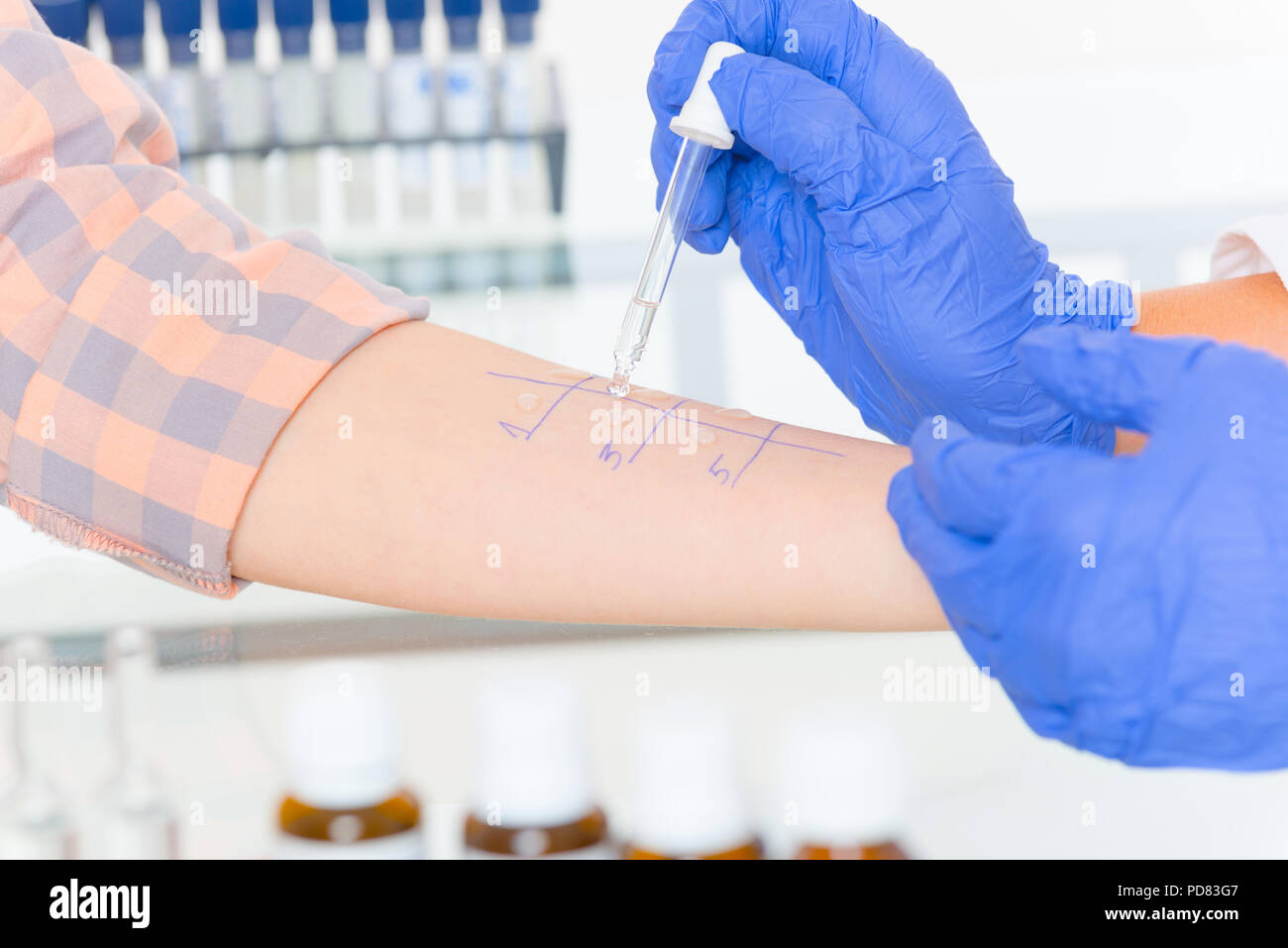 Medical doctor doing allergy tests in laboratory Stock Photo Alamy