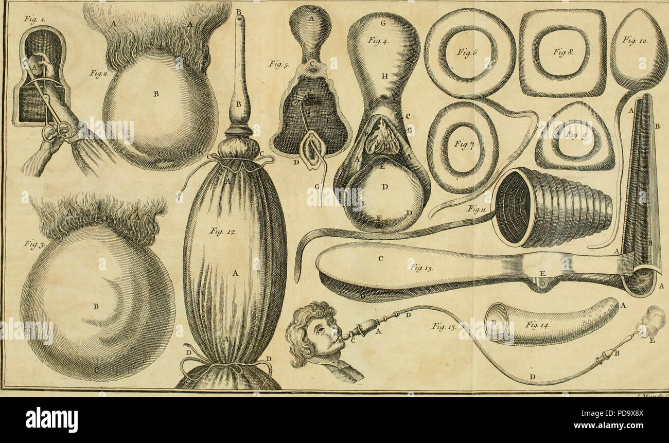 A general system of surgery in three parts : Containing the doctrine and management, I. Of wounds, fractures, luxations, tumours, and ulcers, of all kinds. II. Of the several operations performed on all parts of the body. III. Of the several bandages applied in all operations and disorders. The whole illustrated with thirty eight copper-plates, exhibiting all the operations, instruments, bandages, and improvements, according to the modern and most approved practice : to which is prefixed an introduction concerning the nature, origin, progress, and improvements of surgery : with such other prel Stock Photo