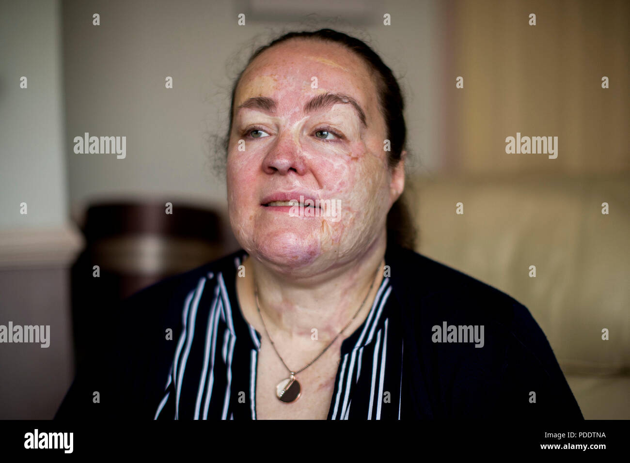 Omagh bombing survivor Donna-Marie McGillion, who wed fellow survivor ...