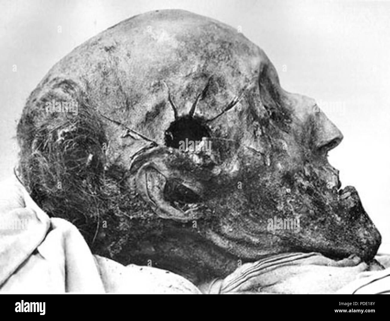 Autopsy examination hi-res stock photography and images - Alamy