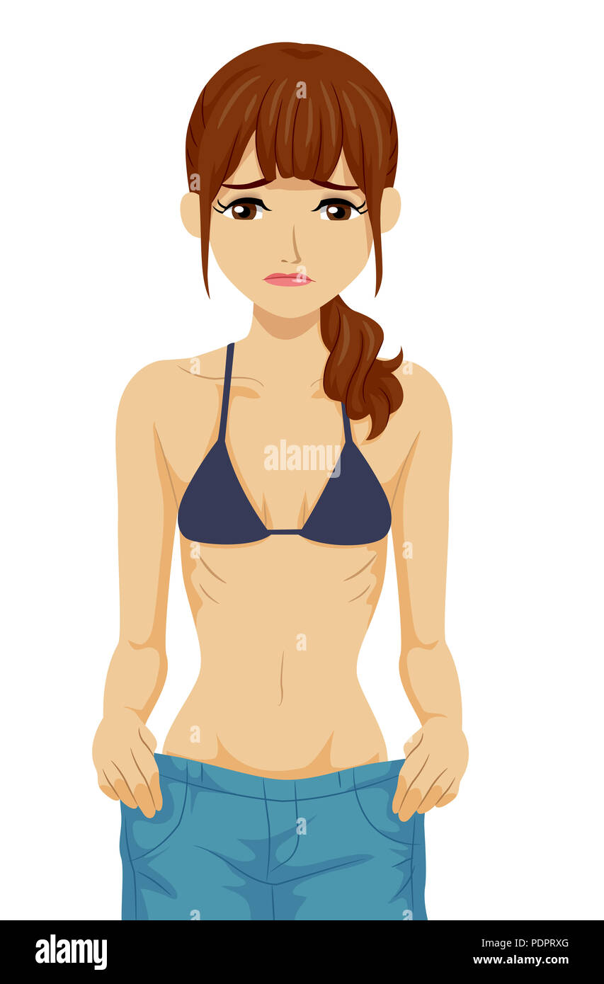 Illustration of an Underweight Teen Girl Showing Recent Weight Loss with a Loose Pants Stock Photo