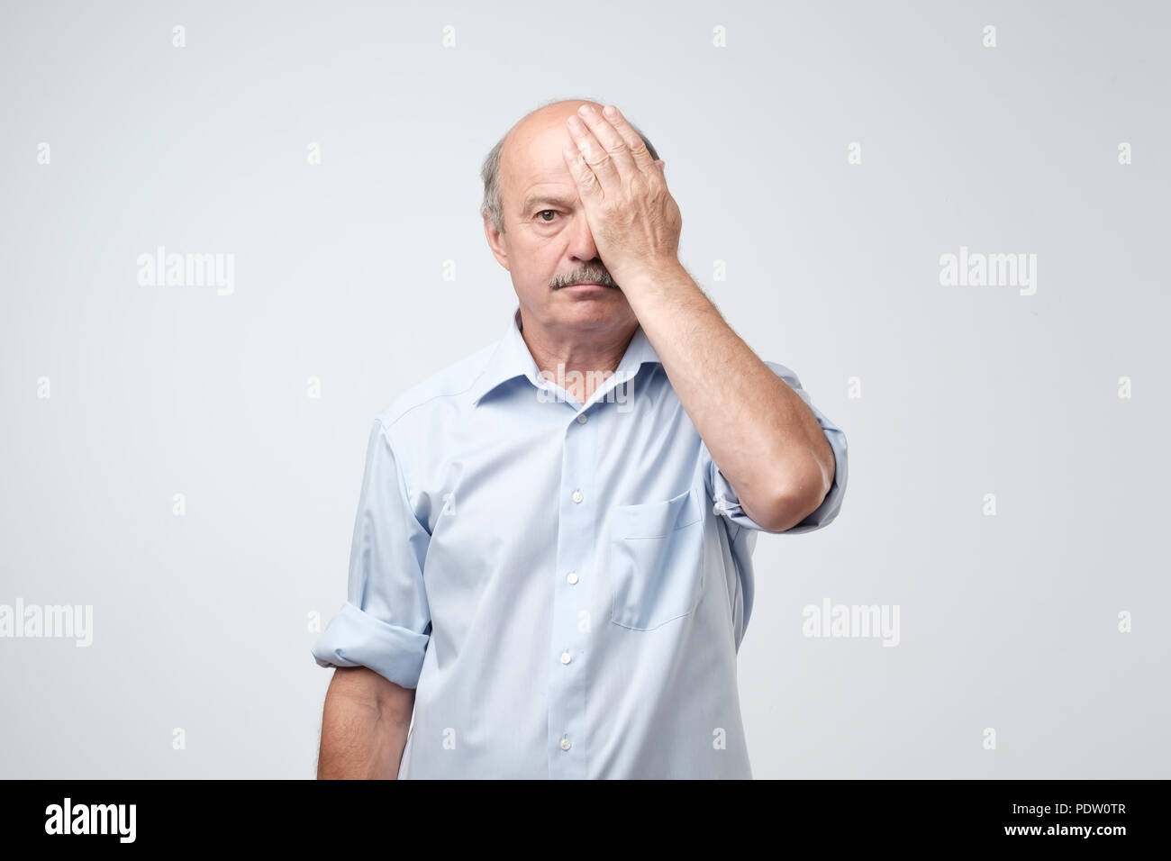 Tired nature european man covering one eye with palm as if having his ...