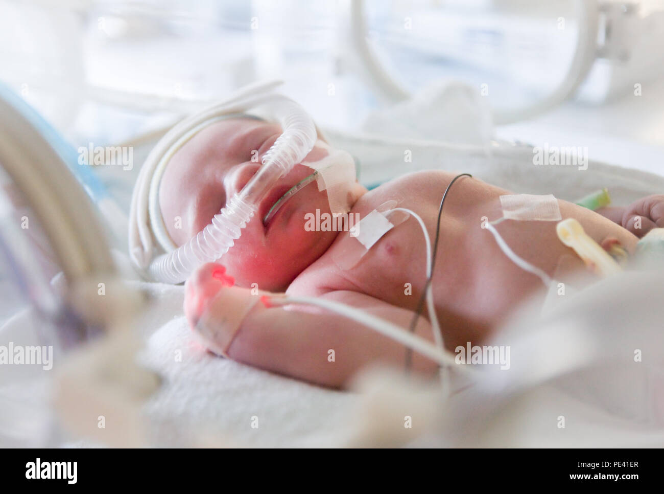 premature baby in incubator Stock Photo