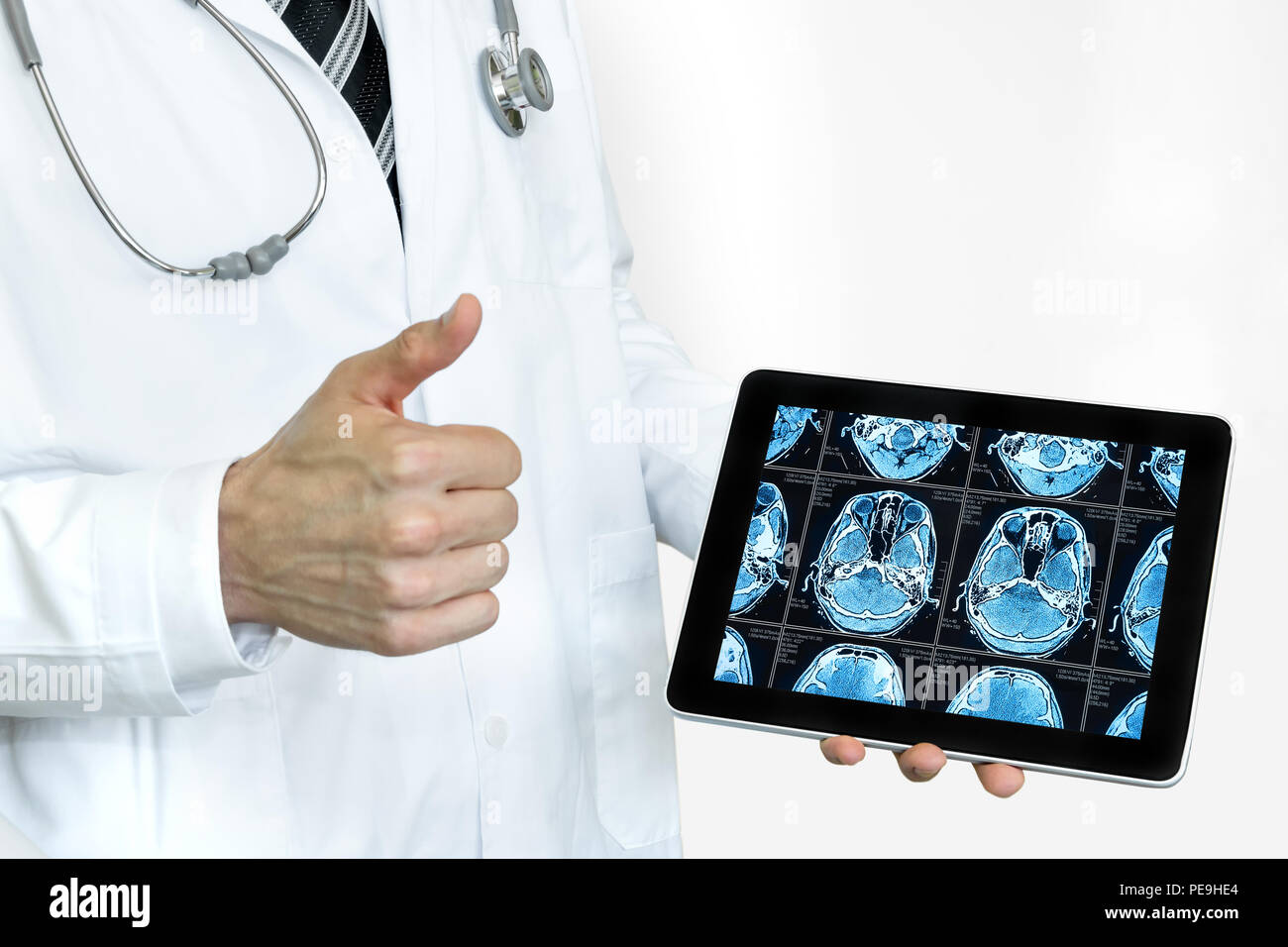 Artificial intelligence in smart healthcare hospital technology concept. Professional doctor use AI biomedical algorithm detect brain Pneumonia and ca Stock Photo