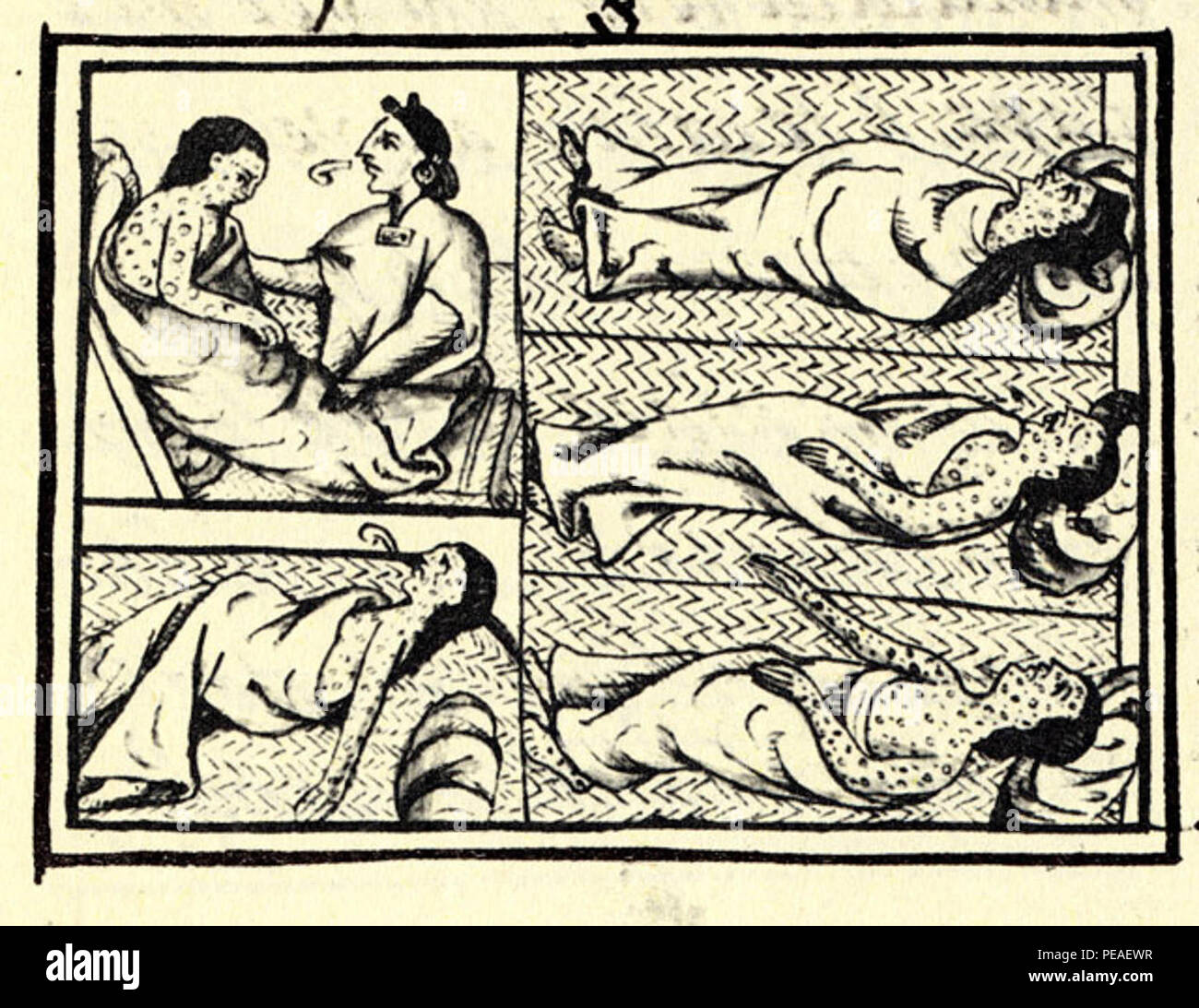 Drawing accompanying text in Book XII of the 16th-century Florentine Codex (compiled 1540–1585) Nahua suffering from smallpox Stock Photo