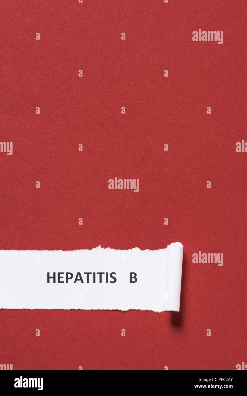 Hepatitis Lettering elevated view of lettering hepatitis b on paper on red background ...