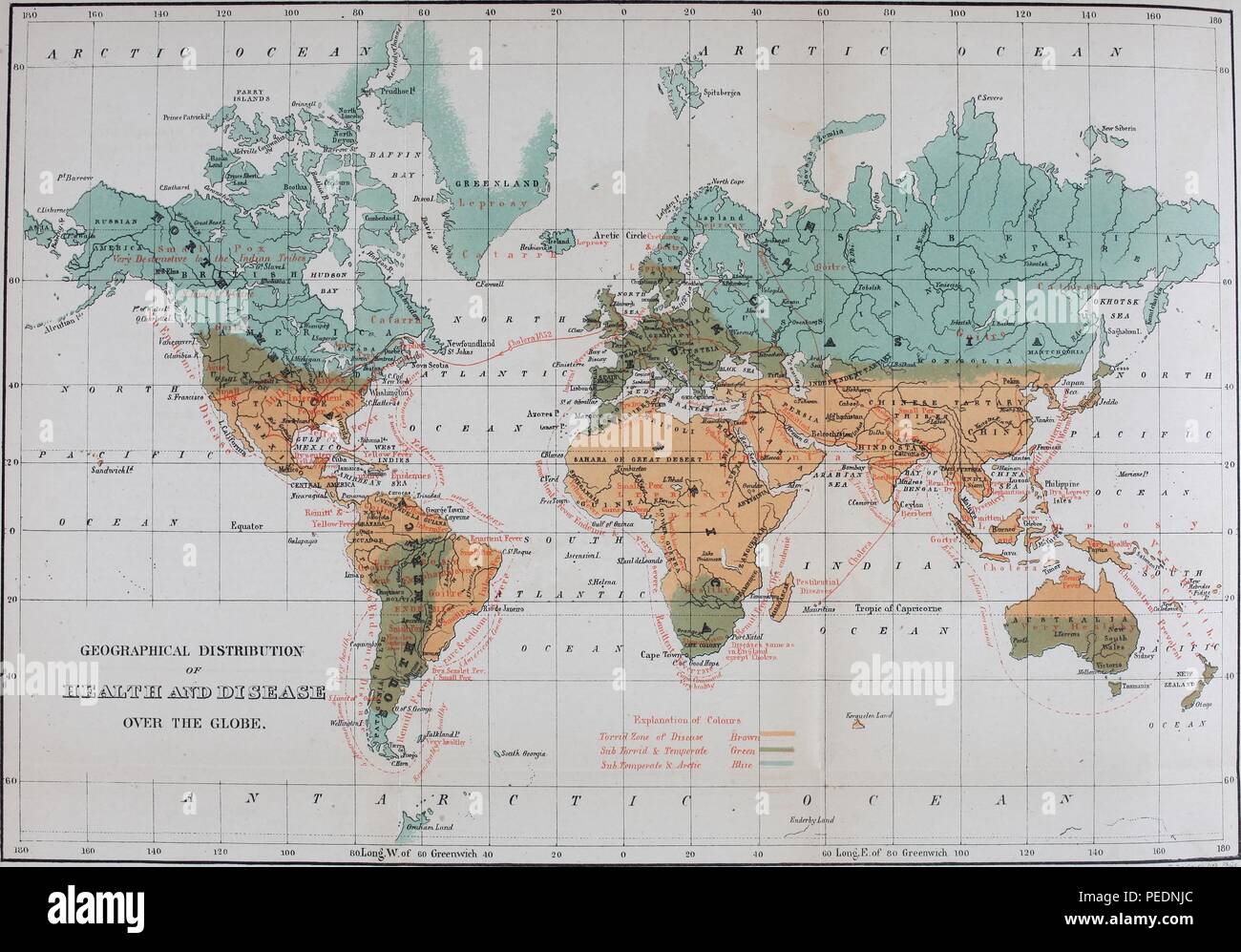 Color map captioned 'geographical distribution of health and disease over the globe, ' with the equatorial areas described as the 'torrid zone of disease, ' illustrating the Victorian belief that temperate climates were healthy while warm climates fostered disease, 1868. Courtesy Internet Archive. () Stock Photo