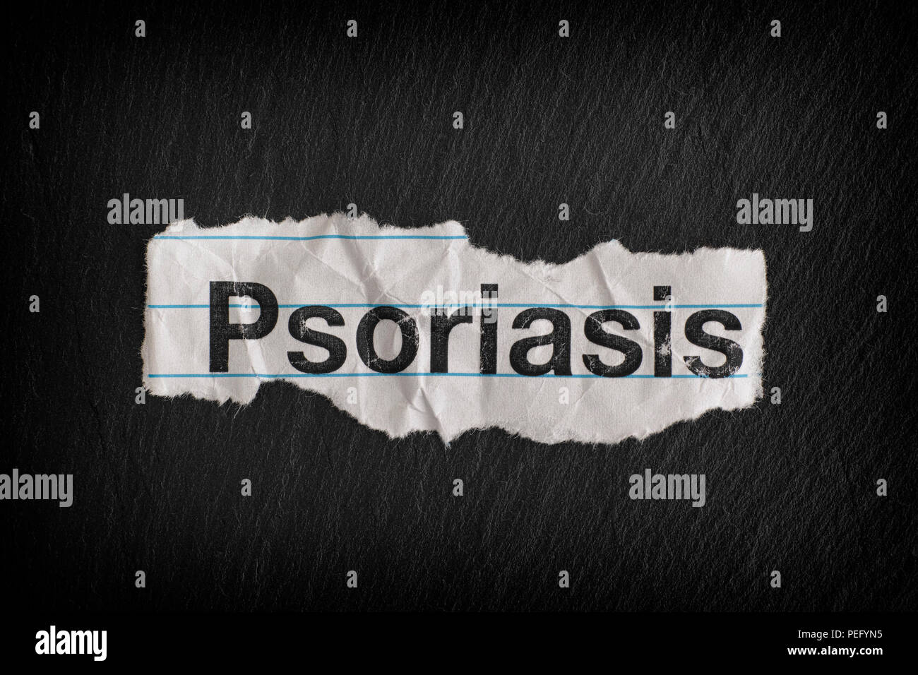 Psoriasis word hi-res stock photography and images - Alamy