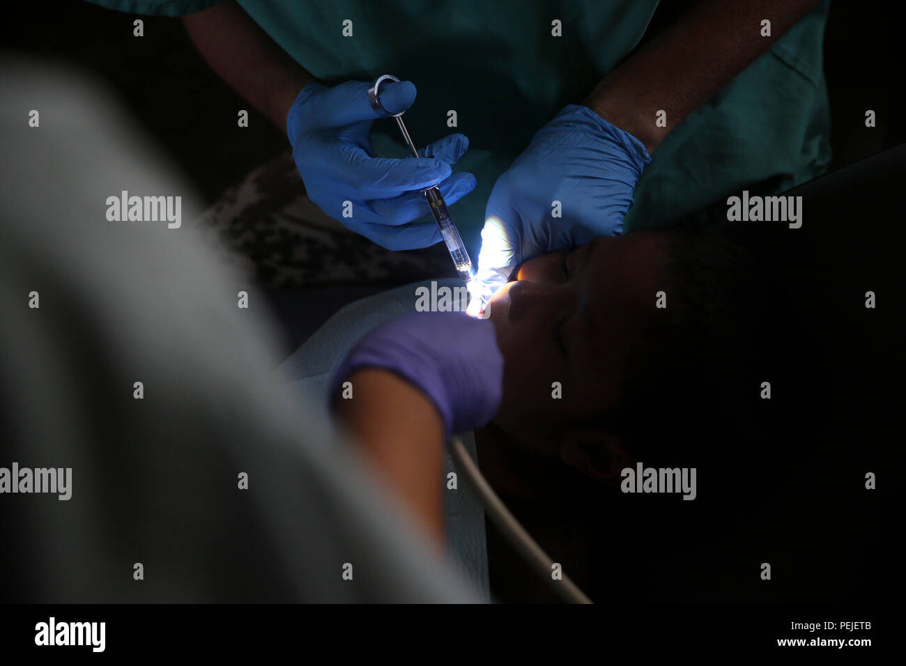Numbing agent hires stock photography and images Alamy