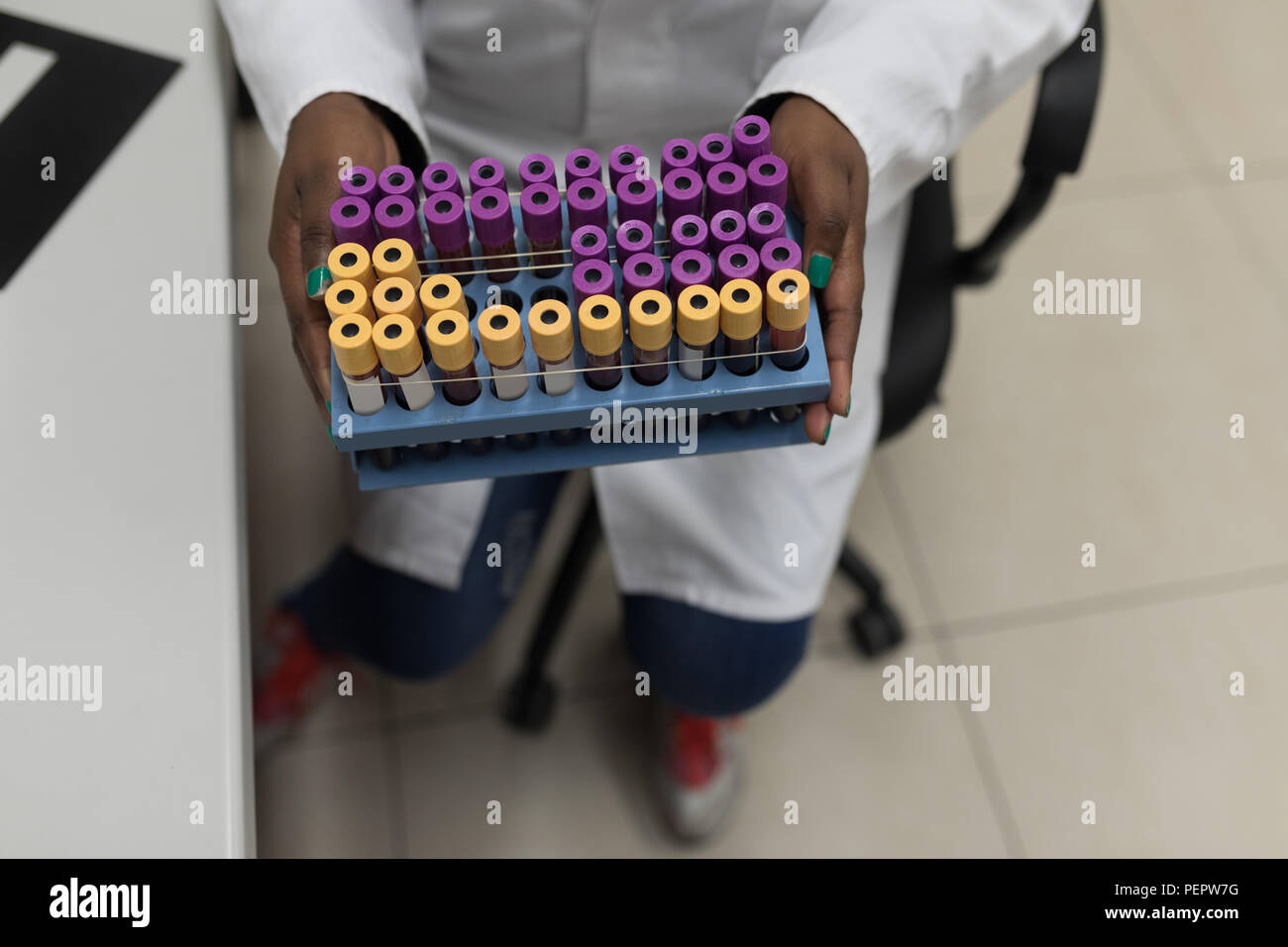 Lab technician holding test tube hi res stock photography and images Lab technician holding test tube hi res stock photography and images