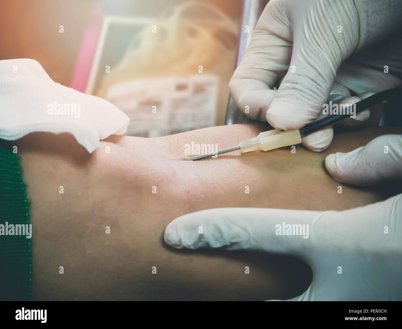 Nurse stabbing medical needles to donor arm. Blood Donor Making Donation In Hospital. Stock Photo