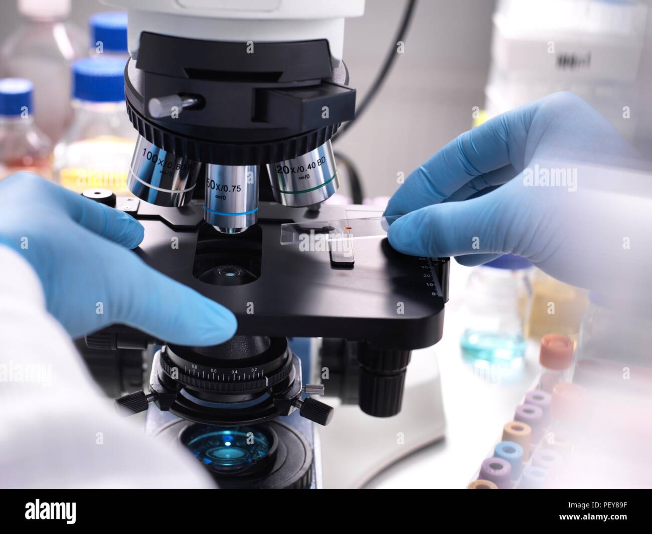 Close-up of a scientist placing a slide containing a human sample under a light microscope for medical testing. Stock Photo