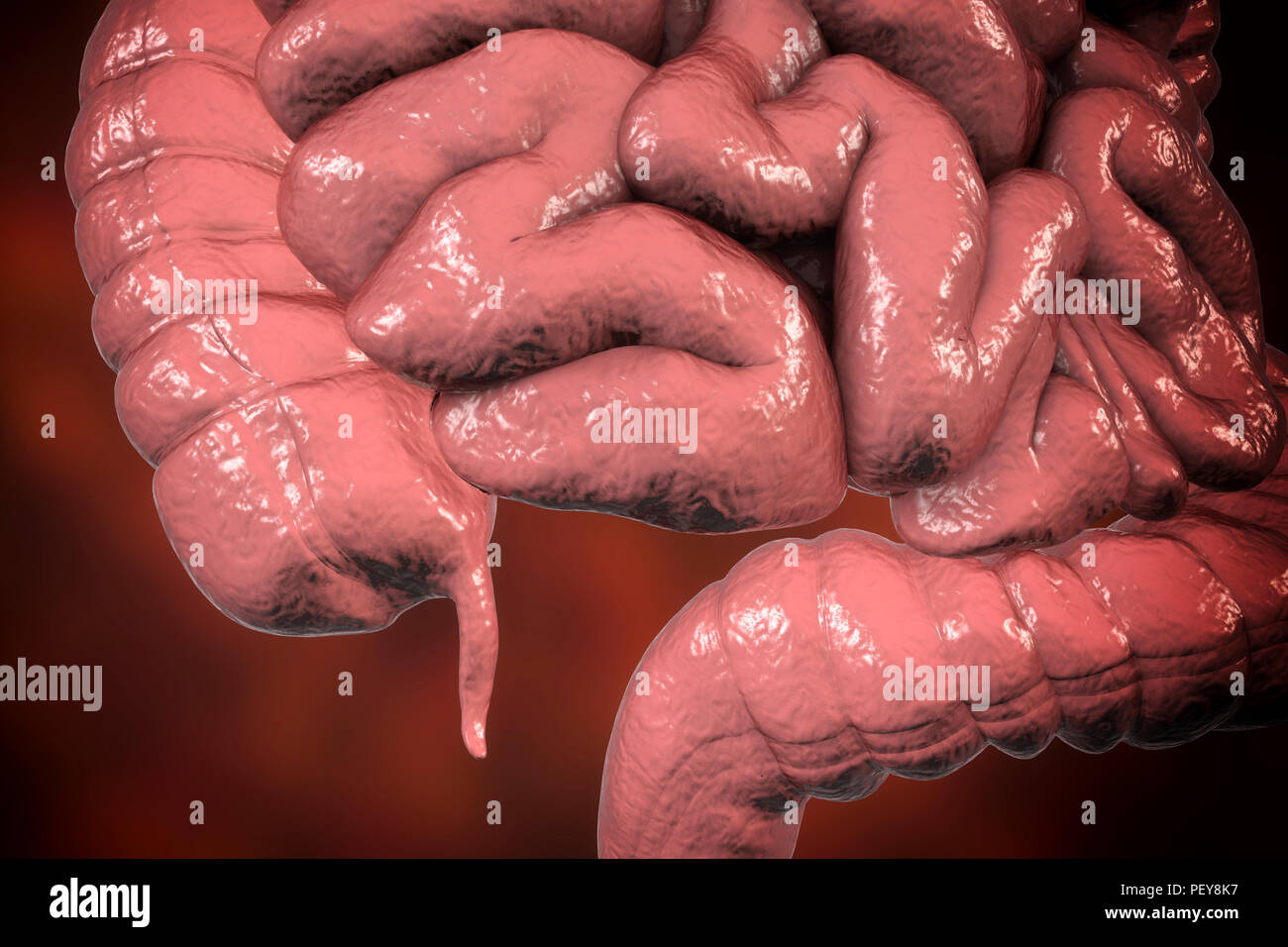 Human appendix, computer illustration Stock Photo - Alamy