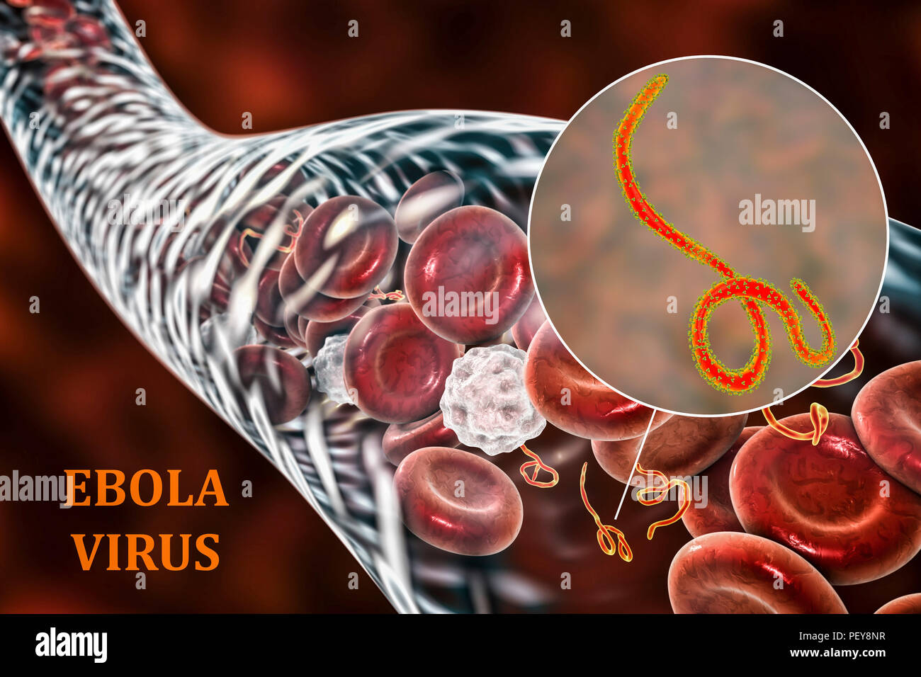 Ebola Virus: When Bad Things Happen to Good Blood Vessels - MedNorthwest