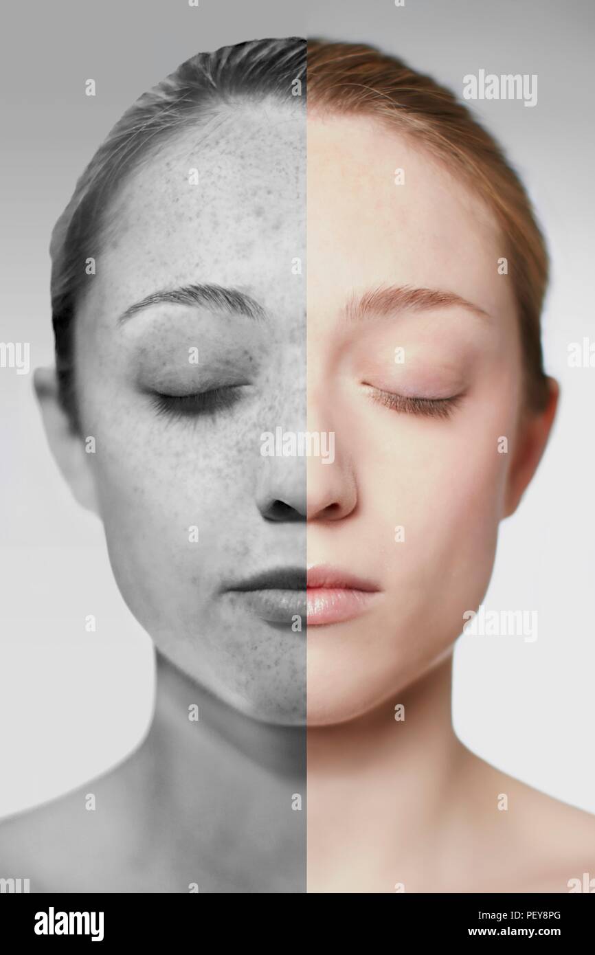 Composite image of showing the damage sun exposure has done to a woman's skin. Stock Photo