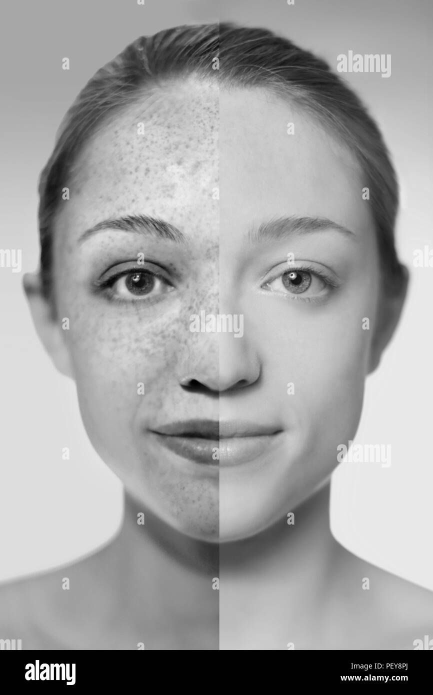 Composite image showing the damage sun exposure has done to a woman's skin. Stock Photo