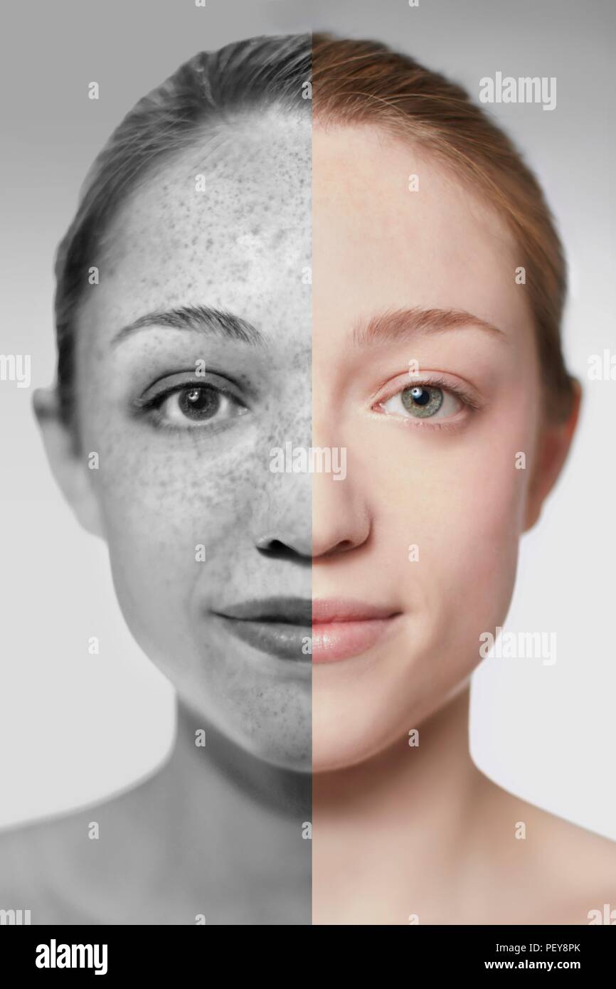 Composite image showing the damage sun exposure has done to a woman's skin. Stock Photo