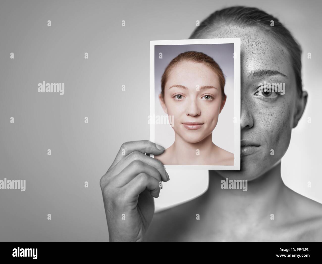 Sun damage. Woman showing the damage sun exposure has done to her skin. Stock Photo