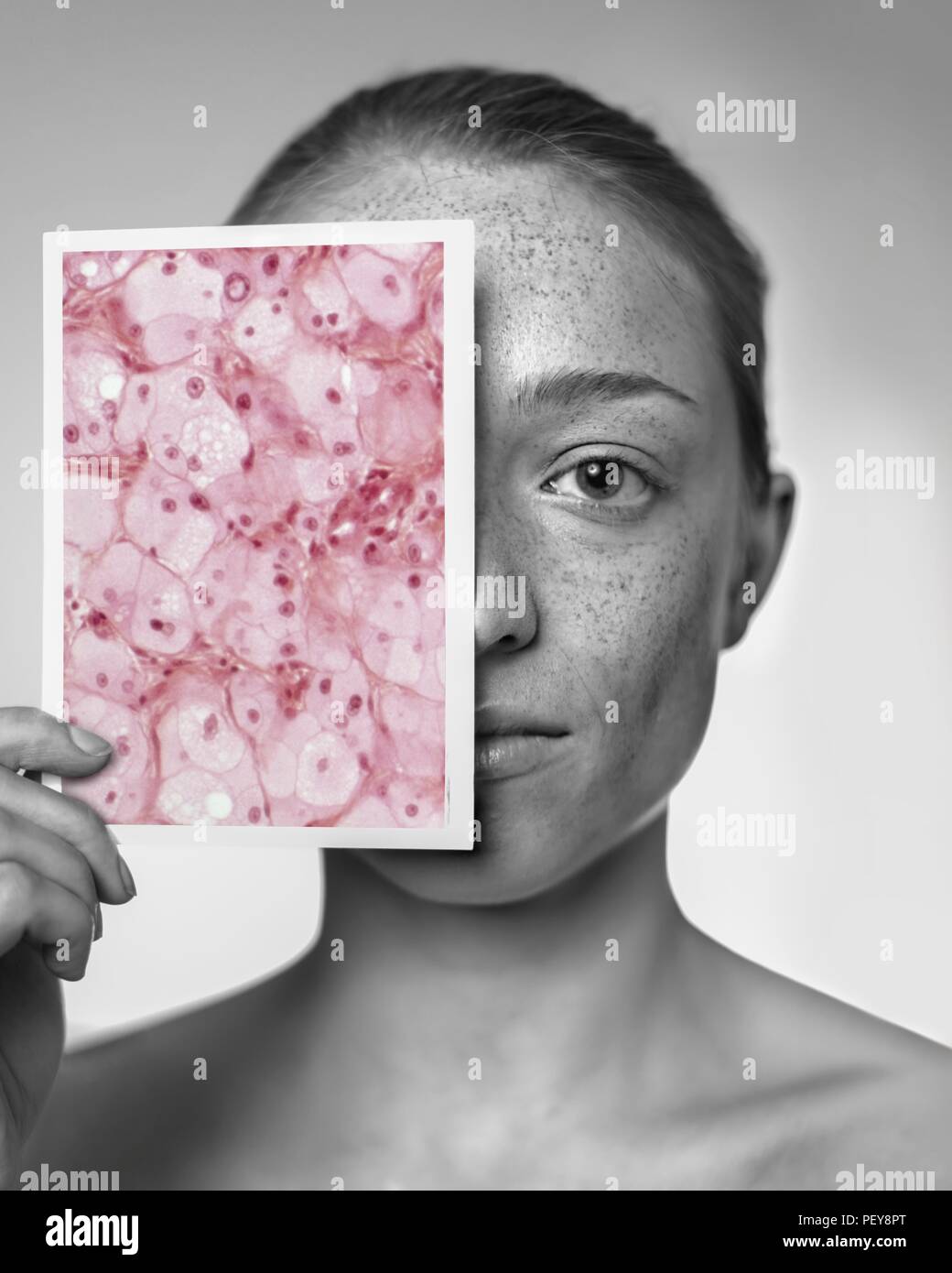 Sun damage. Woman holding a light micrograph in front of her face showing the damage sun exposure has done to her skin. Stock Photo