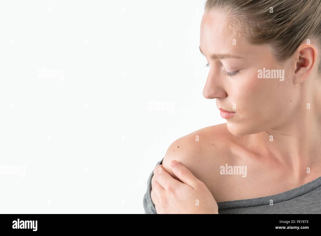 Woman checking moles on shoulder. Stock Photo