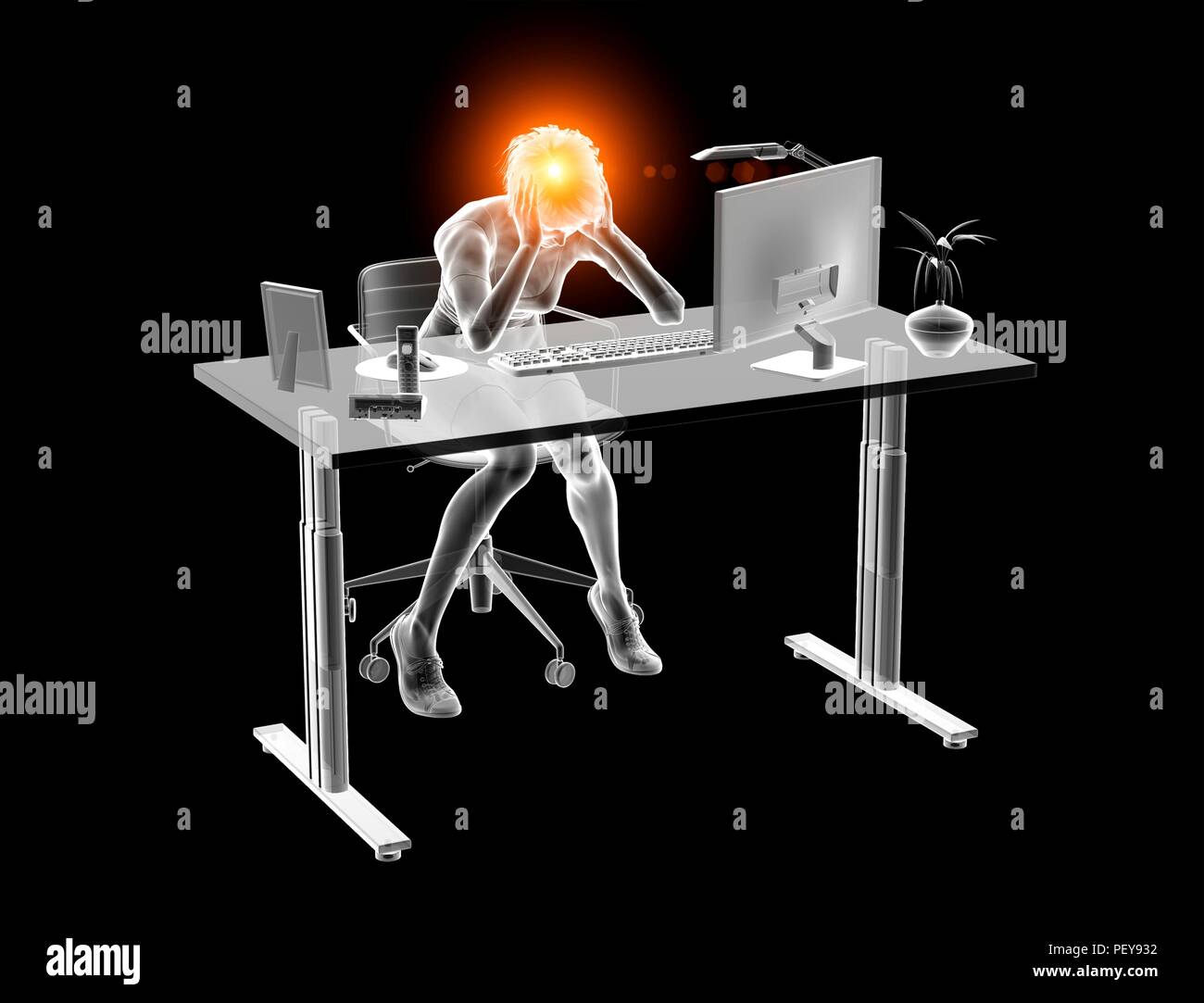 Migraine Illustration High Resolution Stock Photography and Images - Alamy
