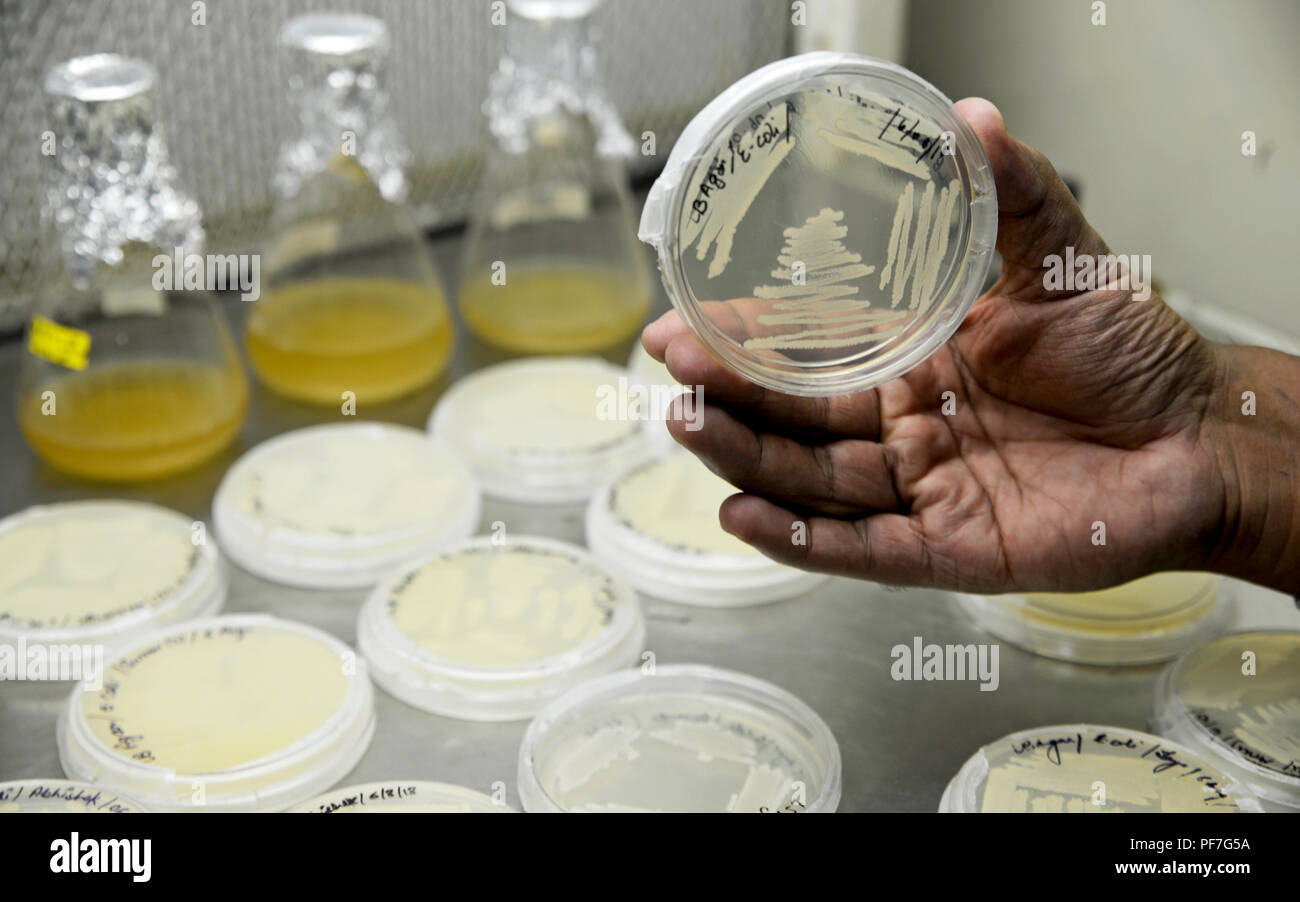Bacteria culture plate Stock Photo Alamy
